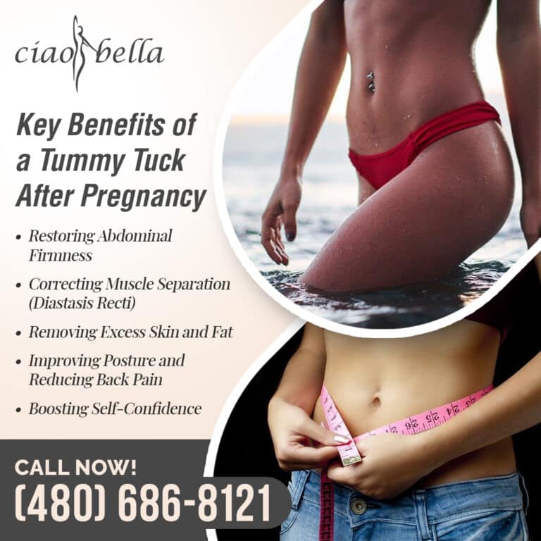 tummy tuck for muscle repair