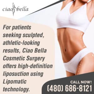 liposuction surgery in Chandler, AZ