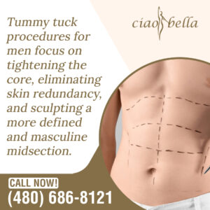 tummy tuck procedure