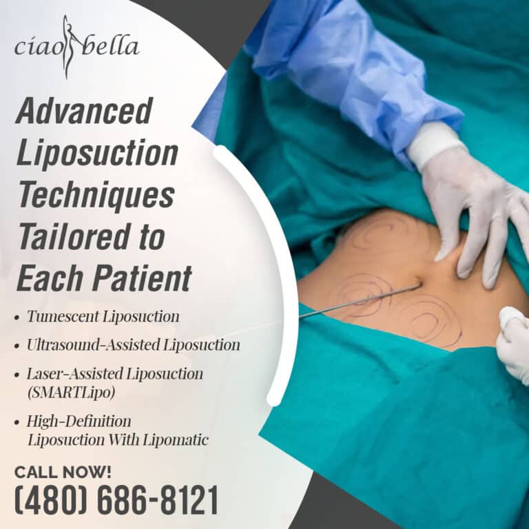 facelift surgery in Chandler