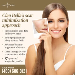 liposuction for love handles