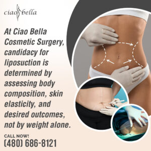 360 liposuction results